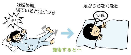 妊娠後期、寝ていると足がつる、足がつらなくなる