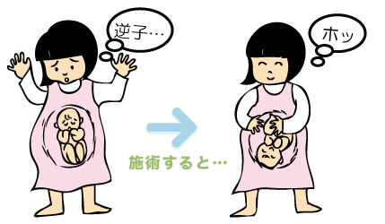 逆子・・・ホッ