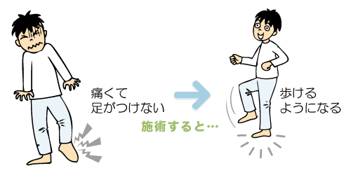 痛くて足がつけない、歩けるようになる