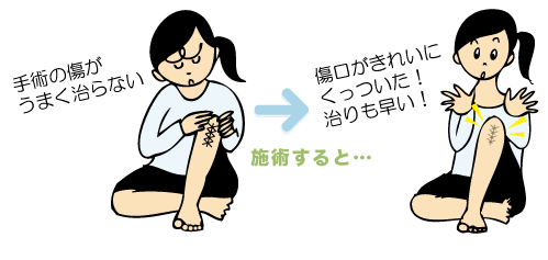 手術の傷がうまく治らない、傷口がきれいにくっついた!治りも早い!
